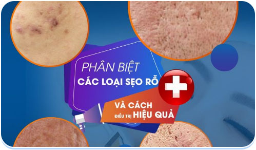 Kiến thức nổi bật