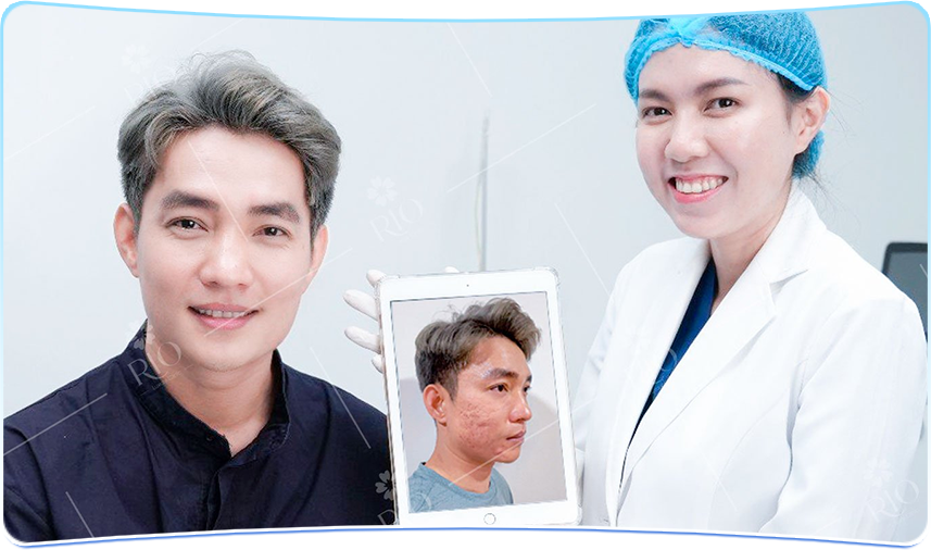 VỀ ĐIỀU TRỊ SẸO RỖ